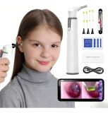 Endoscópio Digital Otoscópio S/ Fio Mini Câmera Recarrega